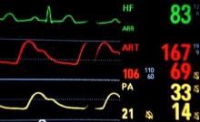 monitor ospedale