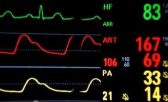 monitor ospedale