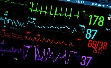 monitor battito cardiaco