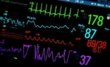 monitor battito cardiaco