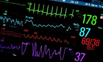monitor battito cardiaco